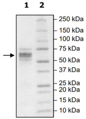 4-20% SDS-PAGE Coomassie Staining.